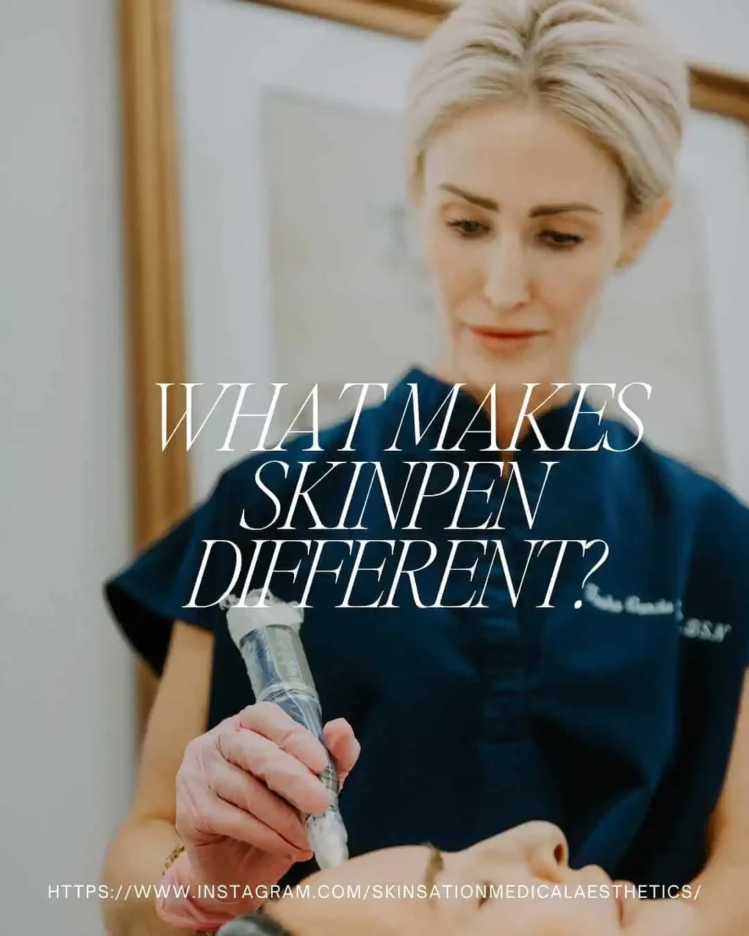 skinpen in Bakersfield, CA | Skinsation Aesthetics